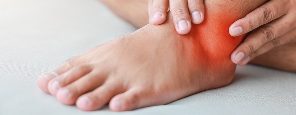 A man injured his ankle and it was swollen and red. Causes of pain include Ankle sprain, Gout, Rheumatoid arthritis, office syndrome, numbness, and cramp symptoms. Healthcare medical concept.